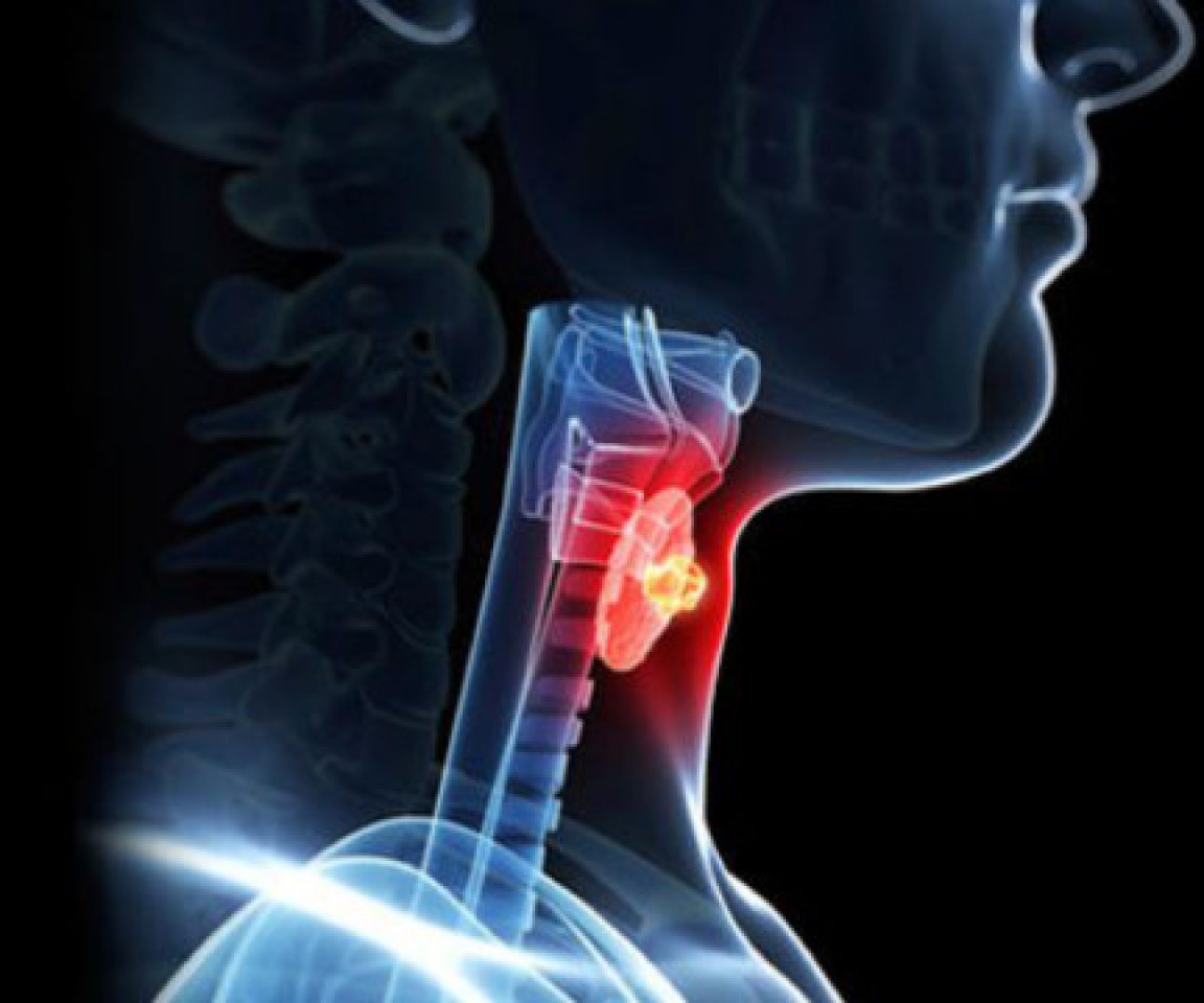 Cirurgia de Cabeça e Pescoço