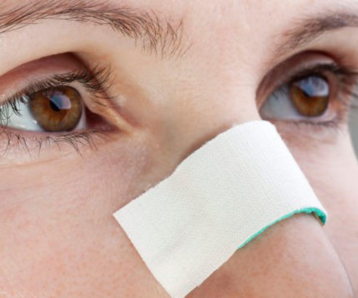 Rinoplastia Primária e Secundária