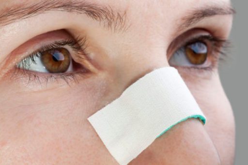 Rinoplastia Primária e Secundária